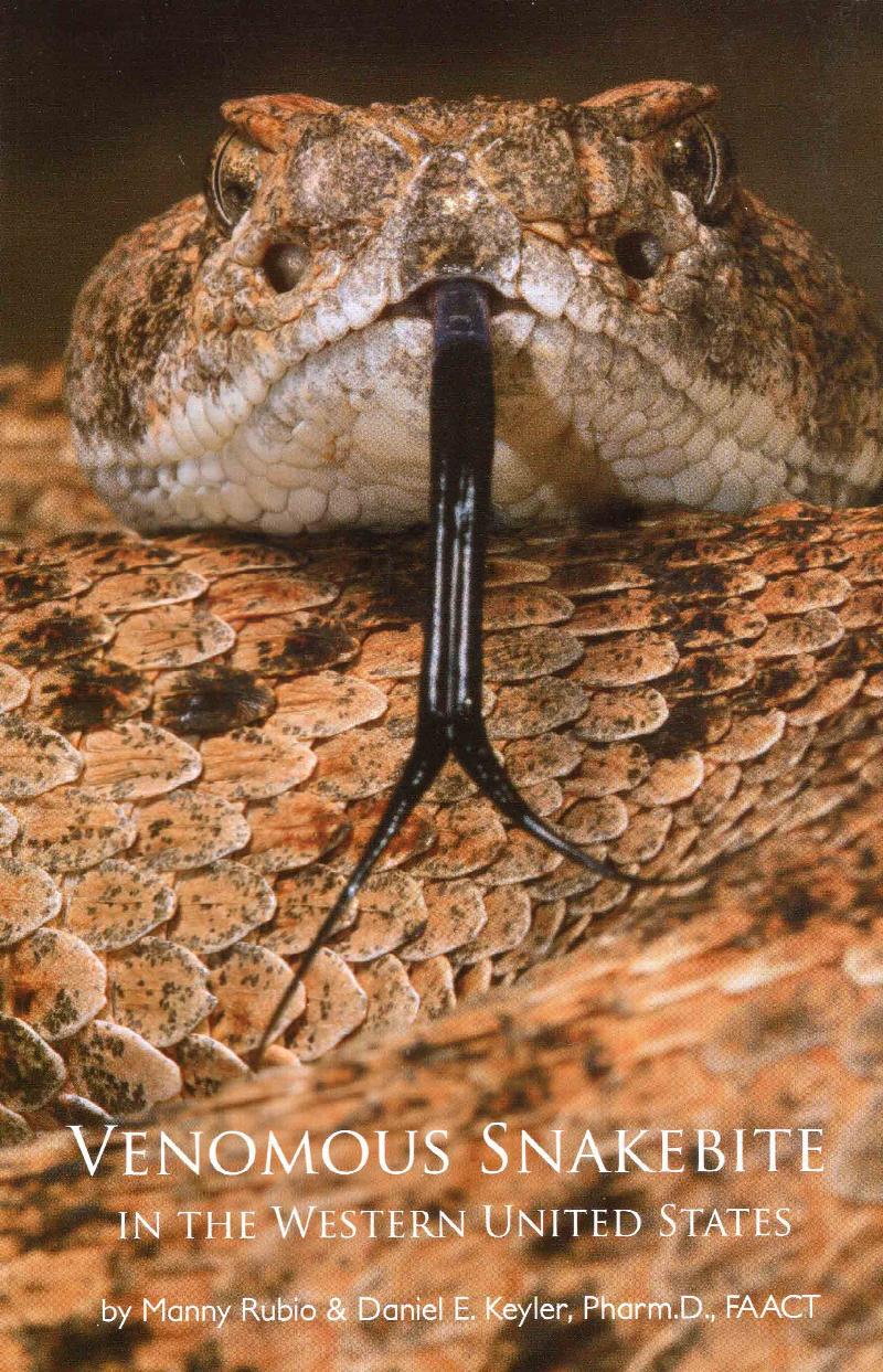 Image for Venomous Snakebite in the Western United States